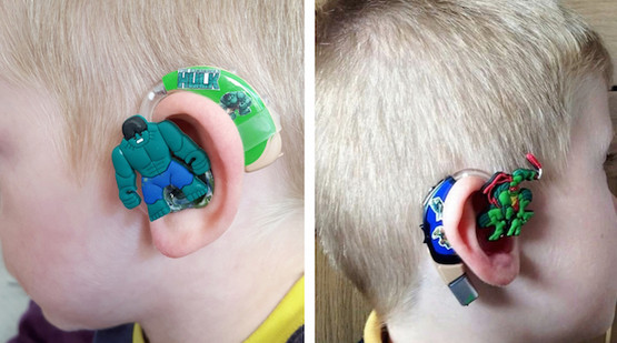 Coolest Mom Ever Designs Superhero Hearing Aids Just For Children